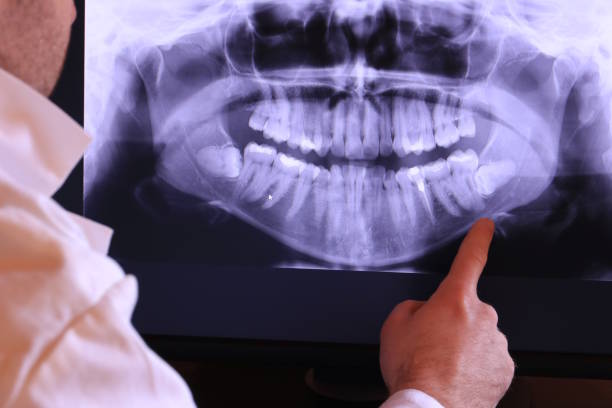 Best Emergency Root Canal Therapy in Cherryville, NC
